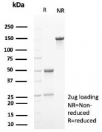 SDS-PAGE analysis of purified, BSA-free P16INK4a antibody (clone rCDKN2A/8062) as confirmation of integrity and purity.