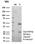 SDS-PAGE analysis of purified, BSA-free p16 antibody (clone CDKN2A/8223R) as confirmation of integrity and purity.