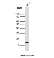 P16INK4a Antibody HeLa WB. Western blot analysis of Cyclin-dependent kinase inhibitor 2A (p16INK4a) expression in HeLa cell lysate using P16INK4a antibody clone CDKN2A/8223R. Lane 1: HeLa cell lysate. A band is detected at approximately 15â17 kDa, consistent with the predicted molecular weight of p16INK4a, a cyclin-dependent kinase inhibitor that regulates G1 cell cycle progression through inhibition of CDK4 and CDK6.