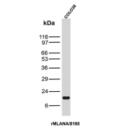 MART-1 Antibody COLO-38 WB. Western blot analysis of human COLO-38 cell lysate using MART-1 antibody clone rMLANA/8180. A distinct band is detected near approximately 18-20 kDa, consistent with the expected molecular weight range of Melanoma antigen recognized by T-cells 1 / MLANA/MART-1, a melanocyte lineage-associated protein involved in melanosome biology and melanoma-associated differentiation pathways. A closely migrating doublet may reflect alternative processing or post-translationally modified MART-1-associated species commonly observed for melanocytic lineage proteins.