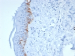 IHC staining of FFPE human skin tissue with MART-1 antibody (clone rMLANA/8180). HIER: boil tissue sections in pH 9 10mM Tris with 1mM EDTA for 20 min and allow to cool before testing.