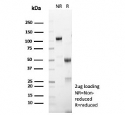 SDS-PAGE analysis of purified, BSA-free MART-1 antibody (clone rMLANA/8134) as confirmation of integrity and purity.