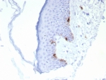 IHC staining of FFPE human skin tissue with MART-1 antibody (clone rMLANA/8134). HIER: boil tissue sections in pH 9 10mM Tris with 1mM EDTA for 20 min and allow to cool before testing.