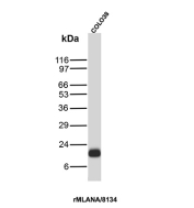MART-1 Antibody COLO 38 WB. Western blot analysis of COLO 38 cell lysate using MART-1 Antibody clone rMLANA/8134. A prominent band is detected near approximately 18-20 kDa, consistent with the expected molecular weight range of Melanoma antigen recognized by T-cells 1 / MLANA/MART-1, a melanocyte lineage-associated protein widely studied in melanoma biology and melanocytic differentiation pathways.