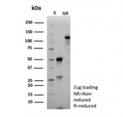 SDS-PAGE analysis of purified, BSA-free recombinant MART-1 antibody (clone MLANA/8108R) as confirmation of integrity and purity.