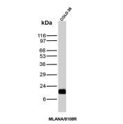 MART-1 Antibody Human COLO-38 Cell WB. Western blot analysis of human COLO-38 cell lysate using MART-1 antibody clone MLANA/8108R. A strong band is detected near approximately 18-20 kDa, consistent with the expected molecular weight range of Melanoma antigen recognized by T-cells 1 / MLANA/MART-1, a melanocyte lineage-associated protein involved in melanosome formation and melanoma differentiation pathways. A closely migrating doublet may represent alternatively processed or post-translationally modified MART-1-associated protein species commonly observed in melanocytic tumor cell lines.