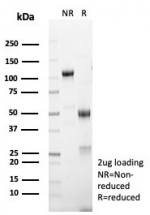 SDS-PAGE analysis of purified, BSA-free Melan-A antibody (clone MLANA/8365R) as confirmation of integrity and purity.