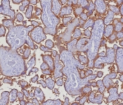 IHC staining of FFPE human placental tissue with PD-L1 antibody (clone PDL1/8222R). HIER: boil tissue sections in pH 9 10mM Tris with 1mM EDTA for 20 min and allow to cool before testing.