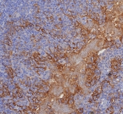IHC staining of FFPE human tonsil tissue with PD-L1 antibody (clone PDL1/8222R). HIER: boil tissue sections in pH 9 10mM Tris with 1mM EDTA for 20 min and allow to cool before testing.