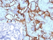 IHC staining of FFPE human placental tissue with PD-L1 antibody (clone PDL1/8591R). Inset: PBS used in place of primary Ab (secondary Ab negative control). HIER: boil tissue sections in pH 9 10mM Tris with 1mM EDTA for 20 min and allow to cool before testing.