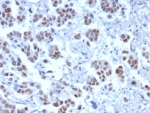 IHC staining of FFPE human bladder tissue with Transducin-like enhancer protein 1 antibody (clone TLE1/8007R). HIER: boil tissue sections in pH 9 10mM Tris with 1mM EDTA for 20 min and allow to cool before testing.