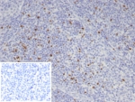 IHC staining of FFPE human tonsil tissue with FOXP3 antibody (clone FOXP3/7990R). Inset: PBS used in place of primary Ab (secondary Ab negative control). HIER: boil tissue sections in pH 9 10mM Tris with 1mM EDTA for 20 min and allow to cool before testing.