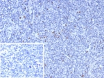 IHC staining of FFPE human tonsil tissue with Forkhead box protein P3 antibody (clone FOXP3/8015R). Inset: PBS used in place of primary Ab (secondary Ab negative control). HIER: boil tissue sections in pH 9 10mM Tris with 1mM EDTA for 20 min and allow to cool before testing.