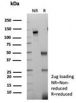 SDS-PAGE analysis of purified, BSA-free Tropomyosin-related kinase B antibody (clone NTRK2/7926) as confirmation of integrity and purity.