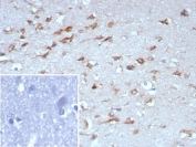 IHC staining of FFPE human brain tissue with Tropomyosin-related kinase B antibody (clone NTRK2/7926). Inset: PBS used in place of primary Ab (secondary Ab negative control). HIER: boil tissue sections in pH 9 10mM Tris with 1mM EDTA for 20 min and allow to cool before testing.