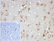 IHC staining of FFPE human brain tissue with TrkB antibody (clone NTRK2/7928). Inset: PBS used in place of primary Ab (secondary Ab negative control). HIER: boil tissue sections in pH 9 10mM Tris with 1mM EDTA for 20 min and allow to cool before testing.