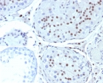IHC staining of FFPE human testis tissue with Steroidogenic Factor 1 antibody (clone SF1/8000R). Inset: PBS used in place of primary Ab (secondary Ab negative control). HIER: boil tissue sections in pH 9 10mM Tris with 1mM EDTA for 20 min and allow to cool before testing.
