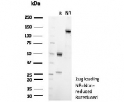SDS-PAGE analysis of purified, BSA-free SF-1 antibody (clone SF1/8150R) as confirmation of integrity and purity.