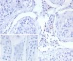 IHC staining of FFPE human testis tissue with SF-1 antibody (clone SF1/8150R). Inset: PBS used in place of primary Ab (secondary Ab negative control). HIER: boil tissue sections in pH 9 10mM Tris with 1mM EDTA for 20 min and allow to cool before testing.