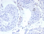 IHC staining of FFPE human testis tissue with SF-1 antibody (clone SF1/8150R). HIER: boil tissue sections in pH 9 10mM Tris with 1mM EDTA for 20 min and allow to cool before testing.