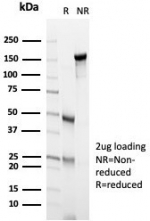 SDS-PAGE analysis of purified, BSA-free Endoglin antibody (clone ENG/4750) as confirmation of integrity and purity.