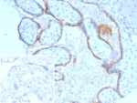 IHC staining of FFPE human placental tissue with Endoglin antibody (clone ENG/4750) Inset: PBS used in place of primary Ab (secondary Ab negative control). HIER: boil tissue sections in pH 9 10mM Tris with 1mM EDTA for 20 min and allow to cool before testing.