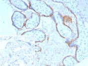 IHC staining of FFPE human placental tissue with ENG antibody (clone ENG/8069R) Inset: PBS used in place of primary Ab (secondary Ab negative control). HIER: boil tissue sections in pH 9 10mM Tris with 1mM EDTA for 20 min and allow to cool before testing.
