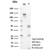 SDS-PAGE analysis of purified, BSA-free CD105 antibody (clone ENG/8961R) as confirmation of integrity and purity.