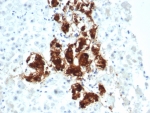 IHC staining of FFPE human adrenal gland tissue with Dopamine Beta-Hydroxylase antibody (clone DBH/7222). HIER: boil tissue sections in pH 9 10mM Tris with 1mM EDTA for 20 min and allow to cool before testing.