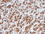 IHC staining of FFPE human adrenal gland tissue with Dopamine Beta-Hydroxylase antibody (clone DBH/7224). HIER: boil tissue sections in pH 9 10mM Tris with 1mM EDTA for 20 min and allow to cool before testing.