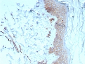 IHC staining of FFPE human skin tissue with Pan-Cadherin antibody (clone Pan-CAD/8020). HIER: boil tissue sections in pH 9 10mM Tris with 1mM EDTA for 20 min and allow to cool before testing.