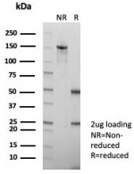 SDS-PAGE analysis of purified, BSA-free HBsAg antibody (clone HBsAG/7666R) as confirmation of integrity and purity.