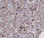 IHC staining of FFPE human placental tissue with dsDNA antibody (clone DSD/8204R). HIER: boil tissue sections in pH 9 10mM Tris with 1mM EDTA for 20 min and allow to cool before testing.