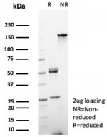 SDS-PAGE analysis of purified, BSA-free Helicobacter pylori antibody (clone HPYL/8548R) as confirmation of integrity and purity.