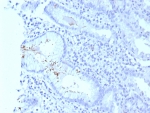 IHC staining of FFPE human H. pylori-infected stomach tissue with H pylori antibody (clone HPYL/8575R). HIER: boil tissue sections in pH 9 10mM Tris with 1mM EDTA for 20 min and allow to cool before testing.