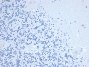 Negative control: IHC testing of FFPE human brain tissue with Tissue Inhibitor of Metalloproteinase 1 antibody (clone TIMP1/4358) at 2ug/ml. HIER: boil tissue sections in pH 9 10mM Tris with 1mM EDTA for 20 min and allow to cool before testing.