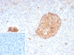 IHC staining of FFPE human pancreas tissue with SYP antibody (clone rSYP/8807). Inset: PBS used in place of primary Ab (secondary Ab negative control). HIER: boil tissue sections in pH 9 10mM Tris with 1mM EDTA for 20 min and allow to cool before testing.