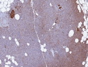 IHC staining of FFPE human pancreas tissue with CD99 antibody (clone MIC2/7866). HIER: boil tissue sections in pH 9 10mM Tris with 1mM EDTA for 20 min and allow to cool before testing.