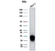 Western blot testing of human MCF-7 cell lysate with CD99 antibody (clone MIC2/7866). Predicted molecular weight: 16-32 kDa depending on the level of glycosylation.