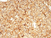 IHC staining of FFPE human pancreas tissue with CD99 antibody (clone MIC2/7864). HIER: boil tissue sections in pH 9 10mM Tris with 1mM EDTA for 20 min and allow to cool before testing.