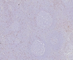 IHC staining of FFPE human tonsil tissue with Scurfin antibody (clone FOXP3/8145R). HIER: boil tissue sections in pH 9 10mM Tris with 1mM EDTA for 20 min and allow to cool before testing.