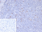 IHC staining of FFPE human tonsil tissue with Scurfin antibody (clone FOXP3/8145R). Inset: PBS used in place of primary Ab (secondary Ab negative control). HIER: boil tissue sections in pH 9 10mM Tris with 1mM EDTA for 20 min and allow to cool before testing.