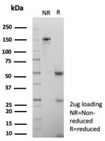 SDS-PAGE analysis of purified, BSA-free FOXP3 antibody (clone FOXP3/8277R) as confirmation of integrity and purity.