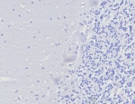 Negative control: IHC testing of FFPE human brain tissue with FOXP3 antibody (clone FOXP3/8277R) at 2ug/ml. HIER: boil tissue sections in pH 9 10mM Tris with 1mM EDTA for 20 min and allow to cool before testing.