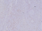 IHC staining of FFPE human tonsil tissue with FOXP3 antibody (clone FOXP3/8277R). HIER: boil tissue sections in pH 9 10mM Tris with 1mM EDTA for 20 min and allow to cool before testing.