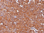 IHC staining of FFPE human adrenal tissue with Synaptophysin antibody (clone SYP/7976R). HIER: boil tissue sections in pH 9 10mM Tris with 1mM EDTA for 20 min and allow to cool before testing.