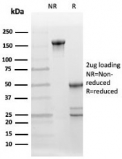 SDS-PAGE analysis of purified, BSA-free BCL-6 corepressor antibody (clone BCOR/2372) as confirmation of integrity and purity.