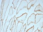 IHC staining of FFPE human skeletal muscle tissue with Dystrophin antibody (clone DMD/8773R). HIER: boil tissue sections in pH 9 10mM Tris with 1mM EDTA for 20 min and allow to cool before testing.