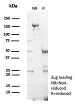SDS-PAGE analysis of purified, BSA-free S100G antibody (clone S100G/7461) as confirmation of integrity and purity.