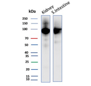 ACE2 Antibody for WB (clone ACE2/7203) in human tissue lysates. Western blot analysis of human kidney (Lane 1) and human small intestine (Lane 2) tissue lysates using ACE2 Antibody for WB detects a band at approximately 95-110 kDa, consistent with the predicted molecular weight of Angiotensin Converting Enzyme 2 / ACE2 and its known glycosylated forms. The stronger band observed in small intestine lysate aligns with the known epithelial enrichment of ACE2 in intestinal tissues.